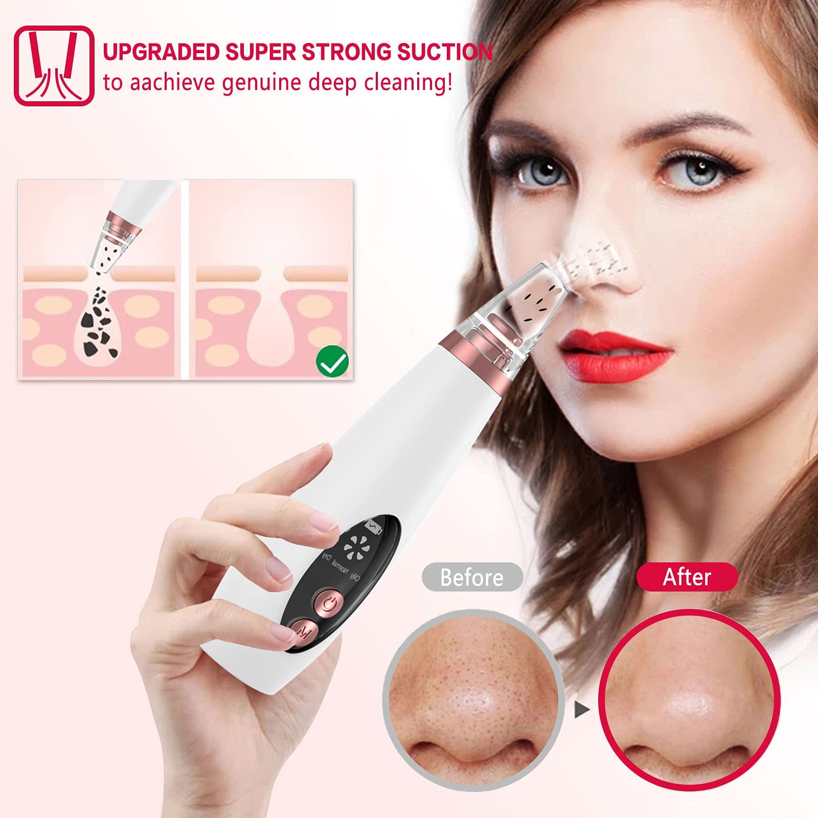 Blackhead Remover Pore Vacuum - 3 Modes, 5 Probes, USB Rechargeable for Clear Skin