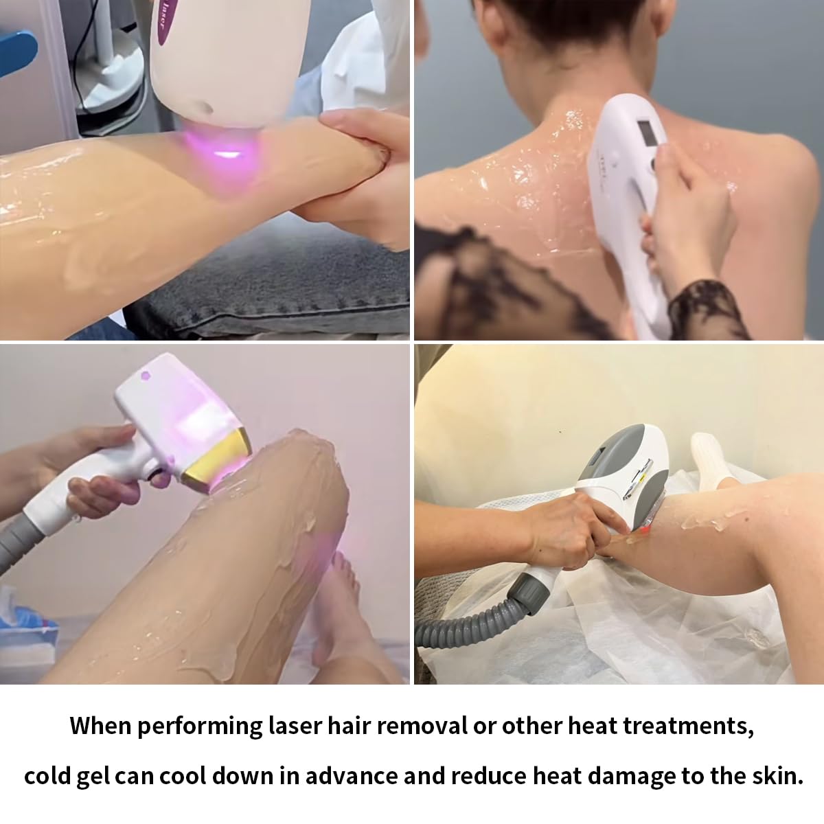 Professional Laser Hair Removal & RF Facial Device for Women & Men - Skin Tightening & Rejuvenation with Cooling Gel - Perfect for Home Spa & Salon Treatments