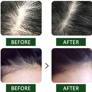 ALPS ORGANIC Rosemary Water Spray for Hair Growth & Thickening | Sulfate-Free, Paraben-Free | 100% Natural & Organic Hair Care (2 x 200ml) | Promotes Healthy Scalp & Shine for Daily Hair Routine