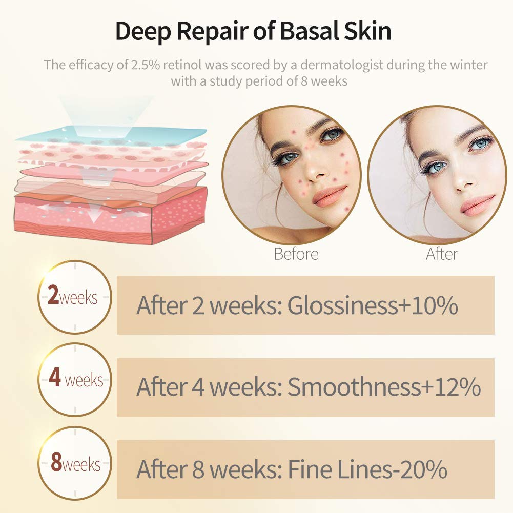 ETRONG 2.5% Retinol Serum for Face - Anti-Aging Treatment with Hyaluronic Acid & Vitamin E - Fights Wrinkles, Acne & Dark Spots (120ml) - Perfect for Nighttime Skincare Routine & Sensitive Skin Care