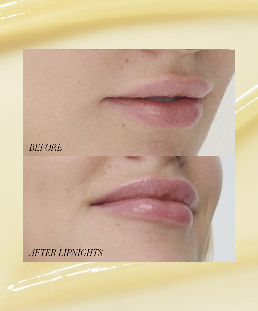Lipnights Overnight Lip Mask - Hydrating & Plumping Treatment for Dry Lips | Perfect for Nighttime Care & Winter Lip Protection