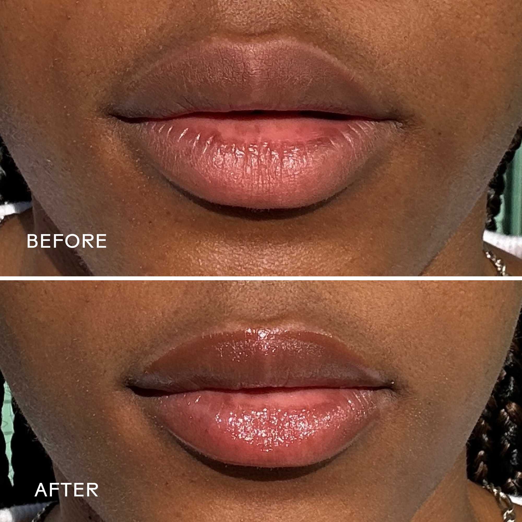 Buttercream Hydrating Lip Mask - Deep Moisturizing Overnight Treatment for Dry, Chapped Lips | Perfect for Night Care & Winter Lip Care