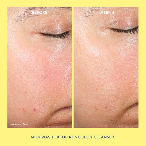 Gentle Milk Wash Exfoliating Jelly Cleanser for Face - Hydrating & Brightening Skincare - Perfect for Daily Use & Sensitive Skin Care Routine