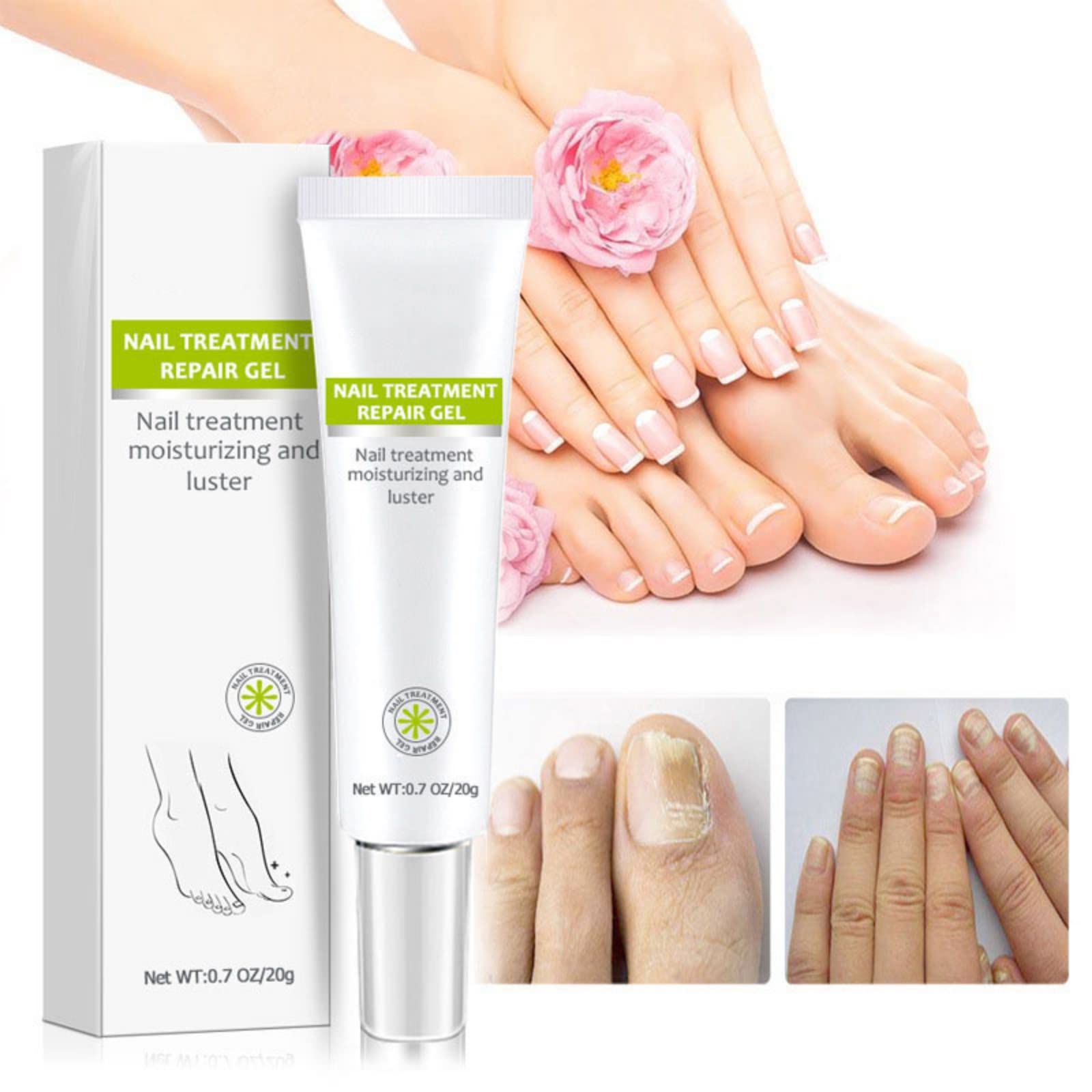 2PCS Nail Repair Gel for Fungal & Damaged Nails - Toenail Treatment & Care - Fast Results in 7 Days - Strengthens & Restores Nails - Perfect for Pedicures, Manicures & At-Home Nail Care