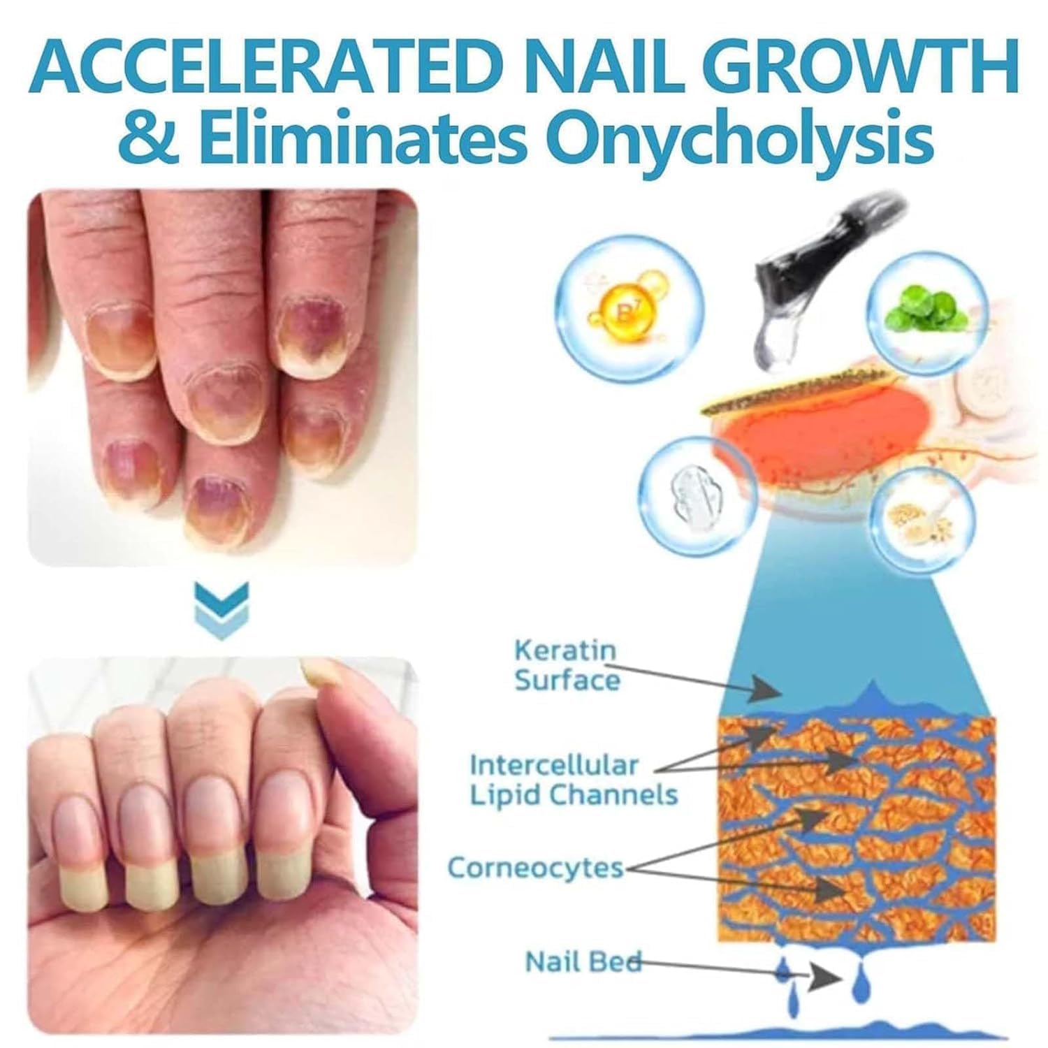 Onyxoguard Nail Growth & Repair Serum - Strengthening Treatment for Thin, Brittle & Damaged Nails - Clear Base Coat Polish for Healthy Nail Care - Perfect for Manicures, Weak Nail Recovery & Daily Nail Protection