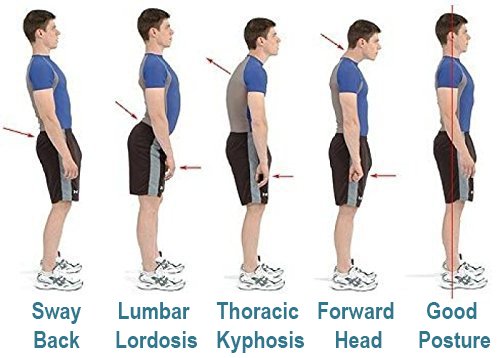 Best Back Support Brace & Posture Corrector for Men, Women & Teens - Relieve Slouching, Kyphosis, Back & Neck Pain - Includes FREE Underarm Pads - Ideal for Office Work, Driving, Gaming & Daily Activities