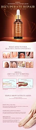 OEDO 30ML Nail Fungus Treatment - Antifungal Foot Care Essence for Toenail Fungus Removal - Anti-Infective Gel for Paronychia & Onychomycosis - Perfect for Athletes, Pedicures & Daily Foot Care