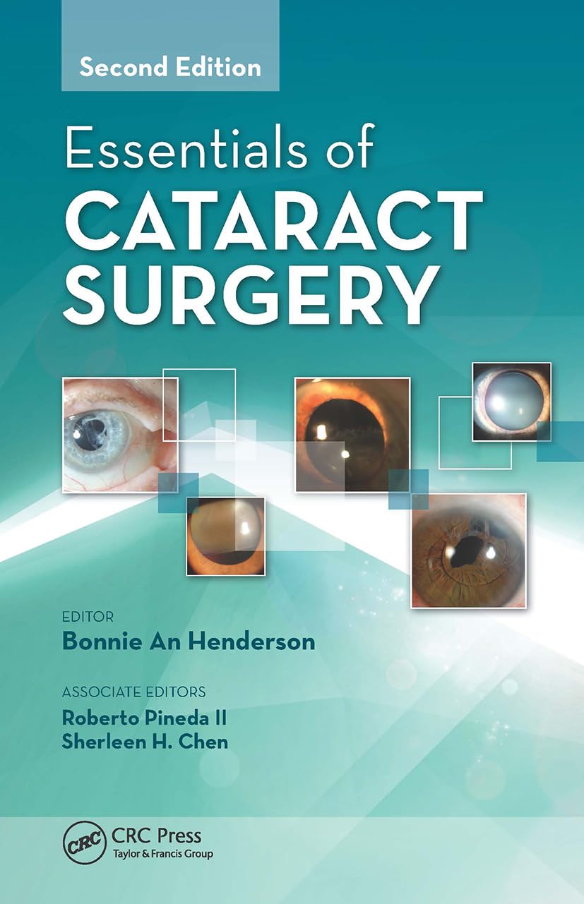 Essentials of Cataract Surgery - Comprehensive Guide for Ophthalmologists & Surgeons | Best Practices & Techniques for Eye Surgery