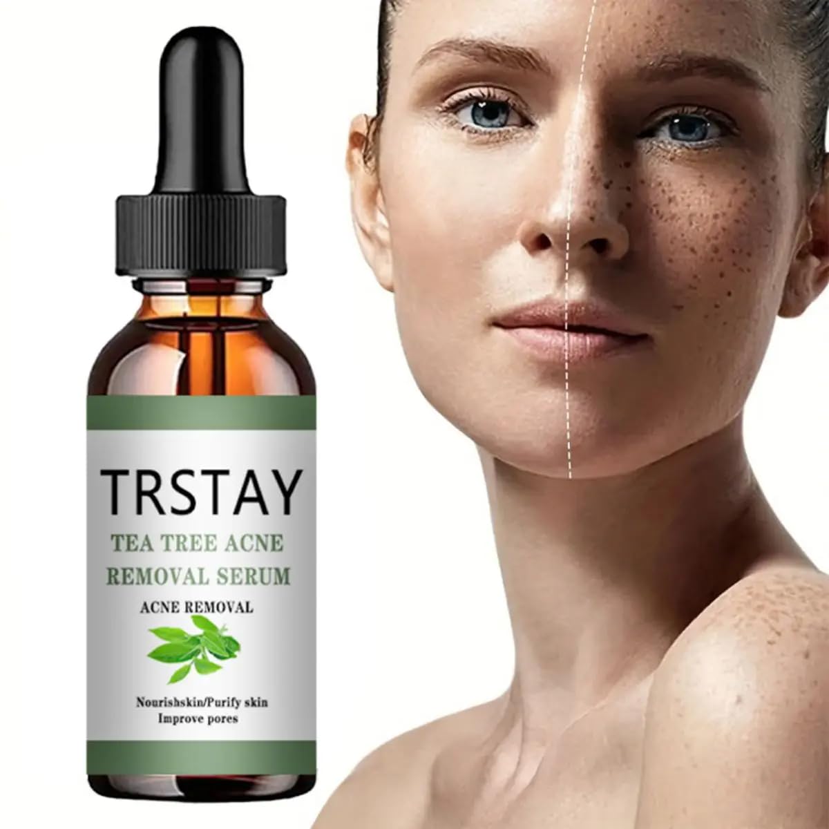 Tea Tree Oil Acne Treatment Face Serum - Korean Skin Care for Moisturizing, Pore Minimizing & Acne Relief | Perfect for Oily, Acne-Prone Skin & Daily Skincare Routine