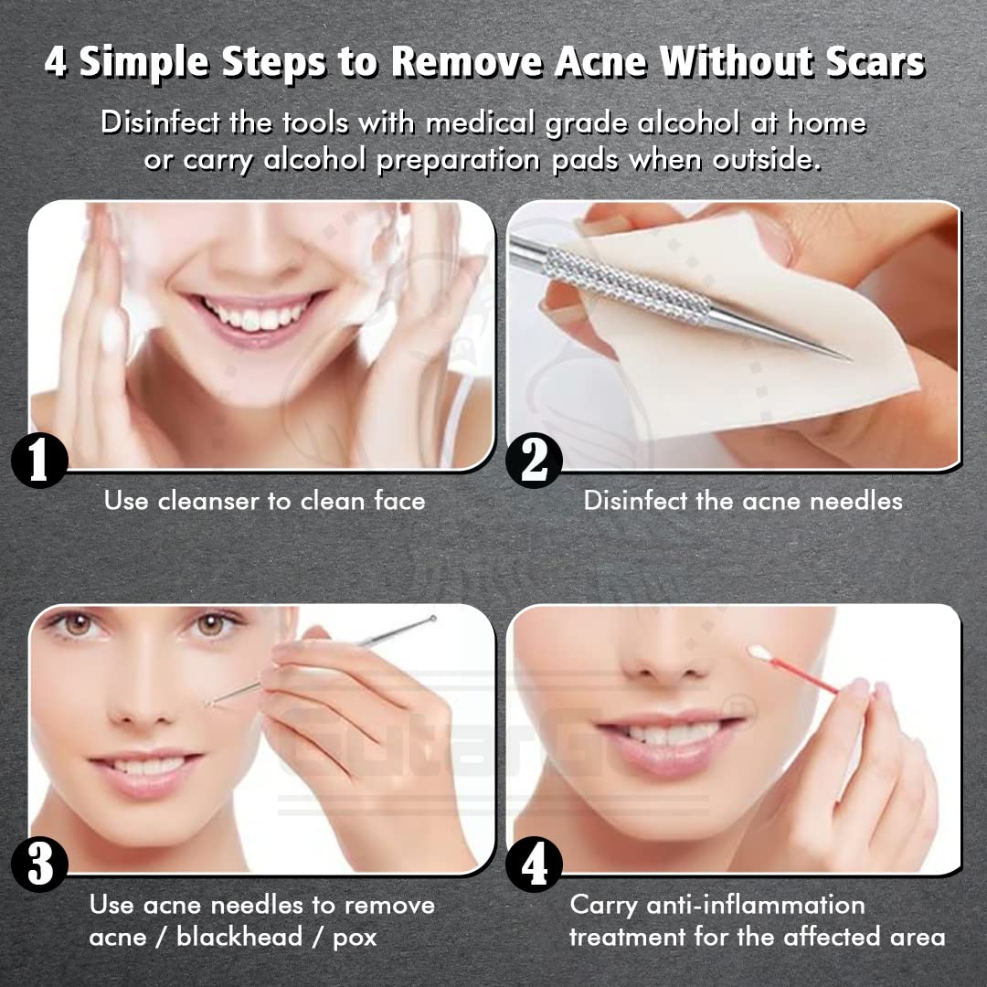 Gutargoo® 4-Piece Blackhead Remover Kit - Stainless Steel Pimple & Comedone Extractor Tool for Acne Treatment, Blemish Removal, Whitehead Popping - Perfect for Face & Nose Care for Women & Men - Ideal for Home Skincare Routine & Travel Beauty Essentials