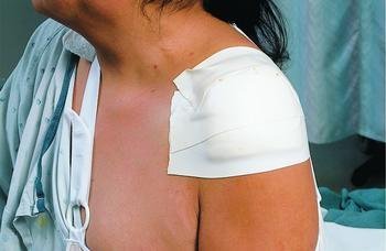 3M Microfoam Tape - 1 Roll (EA) - Medical Grade Adhesive for Wound Care, Bandages & First Aid - Ideal for Hospitals, Clinics & Home Use