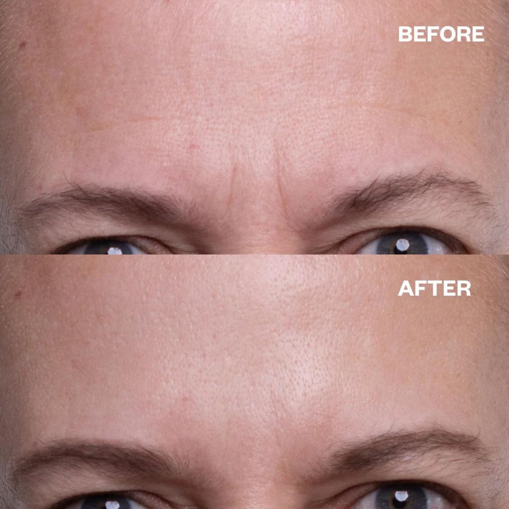Wrinkles Schminkles Forehead Wrinkle Patches - Anti-Aging Smoothing Treatment for Forehead Lines | Reduce Fine Lines & Wrinkles Overnight | Perfect for Nighttime Skincare Routine & Special Events