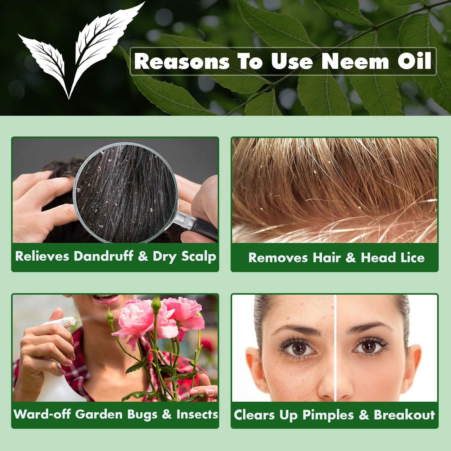 Pure Cold Pressed Neem Oil for Skin, Hair & Scalp Care - 100% Natural Therapeutic Grade Oil for Acne, Dandruff & Bug Repellent (30ml) - Perfect for DIY Beauty, Aromatherapy & Natural Pest Control