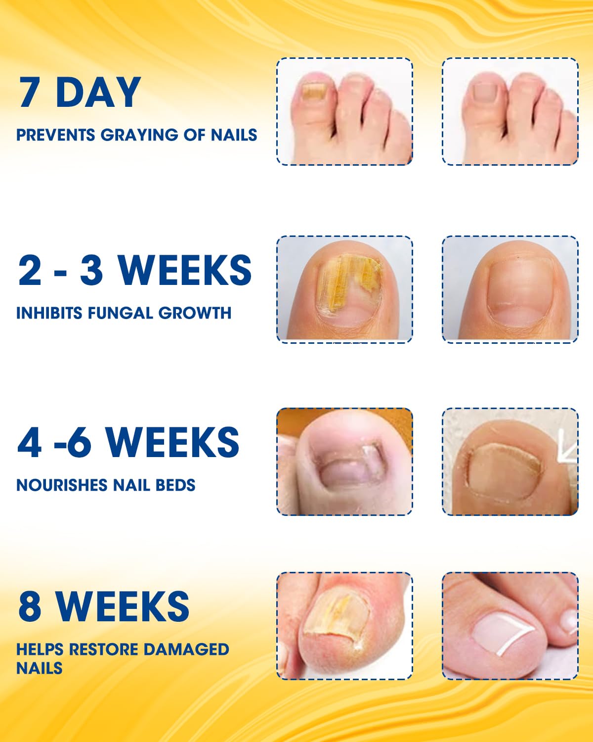 Extra Strength Nail Repair Patches - 28 Count | Damaged Nail Treatment for Discolored & Thickened Nails | 8-Hour Overnight Renewal | Perfect for Pedicures & Nail Care Routine