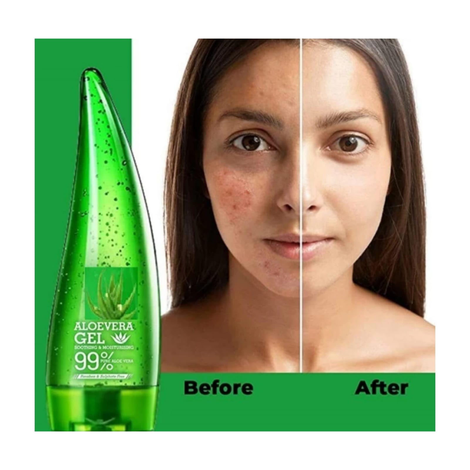 Eshope 99% Pure Aloe Vera Gel - Natural Skin Soothing & Nourishing Moisturizer for Face & Body | Sulfate-Free, Paraben-Free | 100ml Aloe Vera Gel with Free Aloe Face Wash | Perfect for Sunburn Relief, After-Sun Care & Daily Hydration