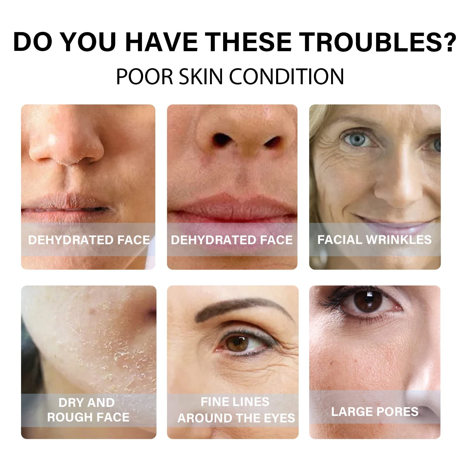 Absorbable Collagen Threads for Face Lift - Invisible Korean Soluble Protein Threads for Wrinkles & Skin Tightening (5 Set) | Anti-Aging Facial Treatment for Smooth & Youthful Skin