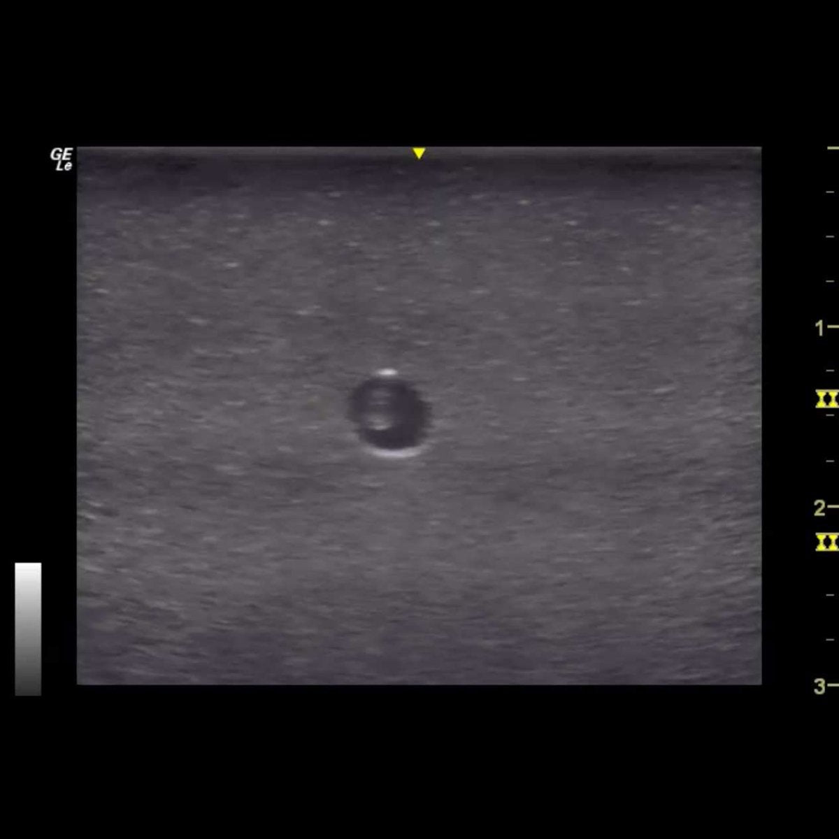 HM4.0 Reusable 4-Vessel Ultrasound Training Model - Perfect for Medical Students, Sonographers & Vascular Practice (Ideal for Carotid, Femoral & Venous Ultrasound Training)