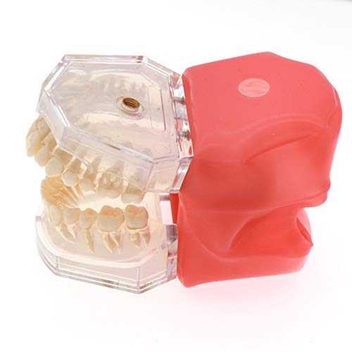 Dentalmall Adult Extractable Tooth Model - Separable Teeth for Dental Learning & Teaching | Perfect for Dental Students, Professionals & Classroom Demonstrations