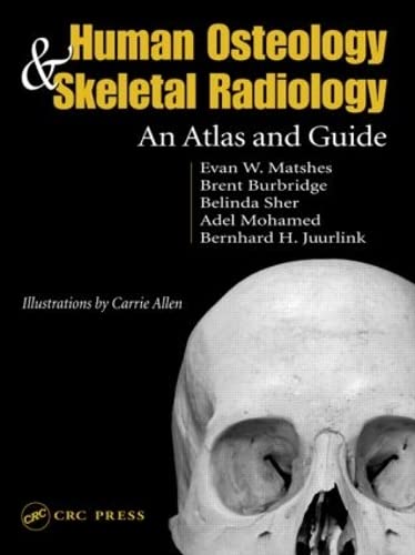 Human Osteology and Skeletal Radiology Atlas - Comprehensive Bone Structure Guide for Medical Students & Professionals | Ideal for Anatomy Study, Forensic Analysis & Clinical Diagnosis
