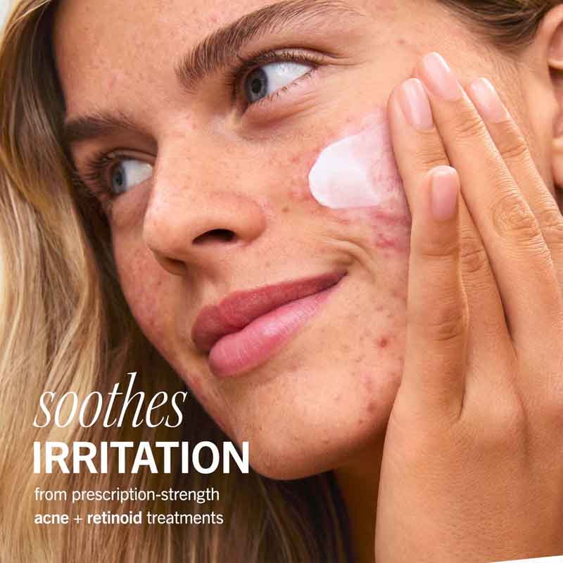 First Aid Beauty Ultra Repair Cream - Intense Hydration & Skin Barrier Repair for Dry, Sensitive Skin | Perfect for Winter Care & Post-Procedure Recovery