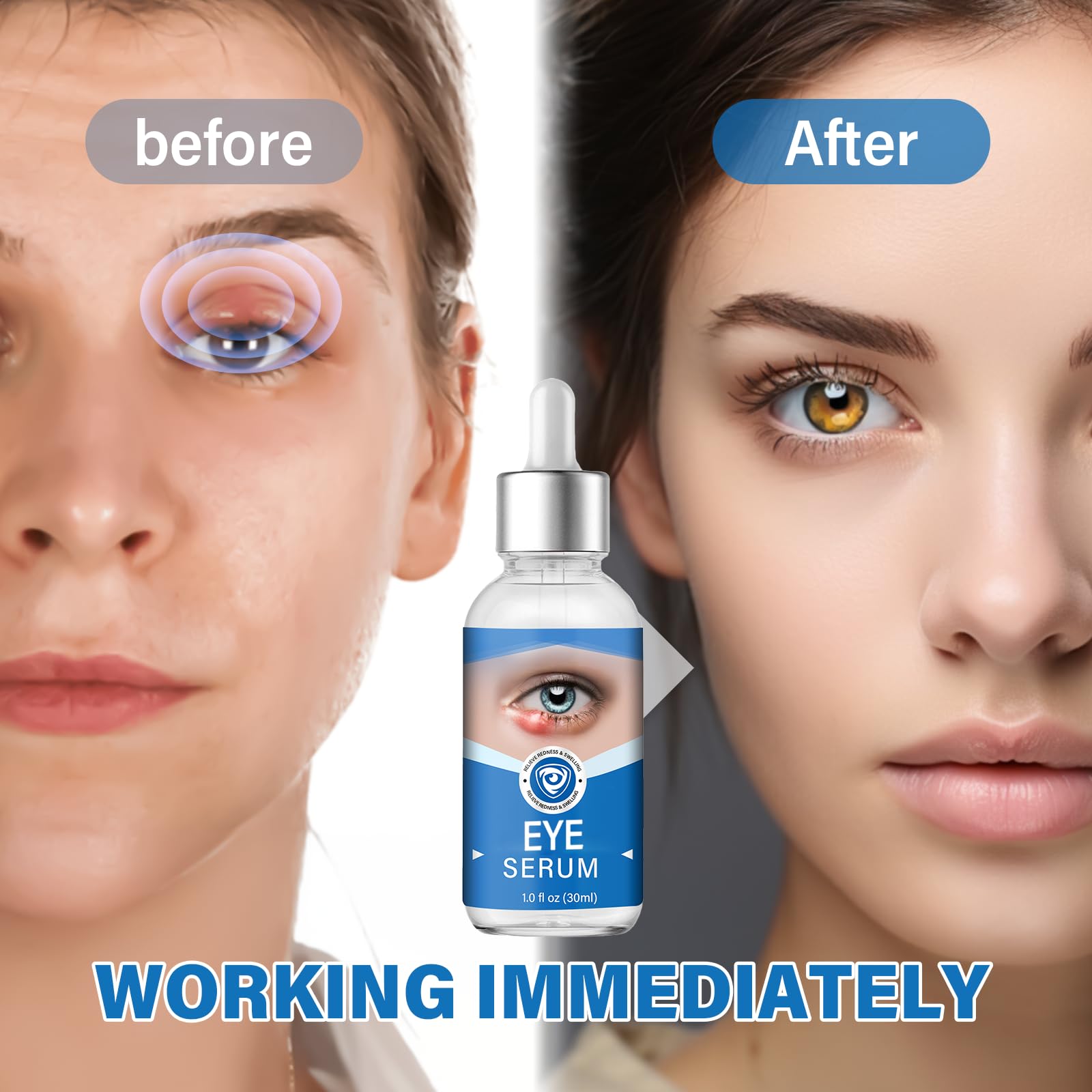 Effective Eye Serum for Chalazion & Blepharitis Treatment - Gentle Lash & Eye Cleanser (30mL) - Soothes Irritation & Promotes Healing for Daily Eye Care Routine