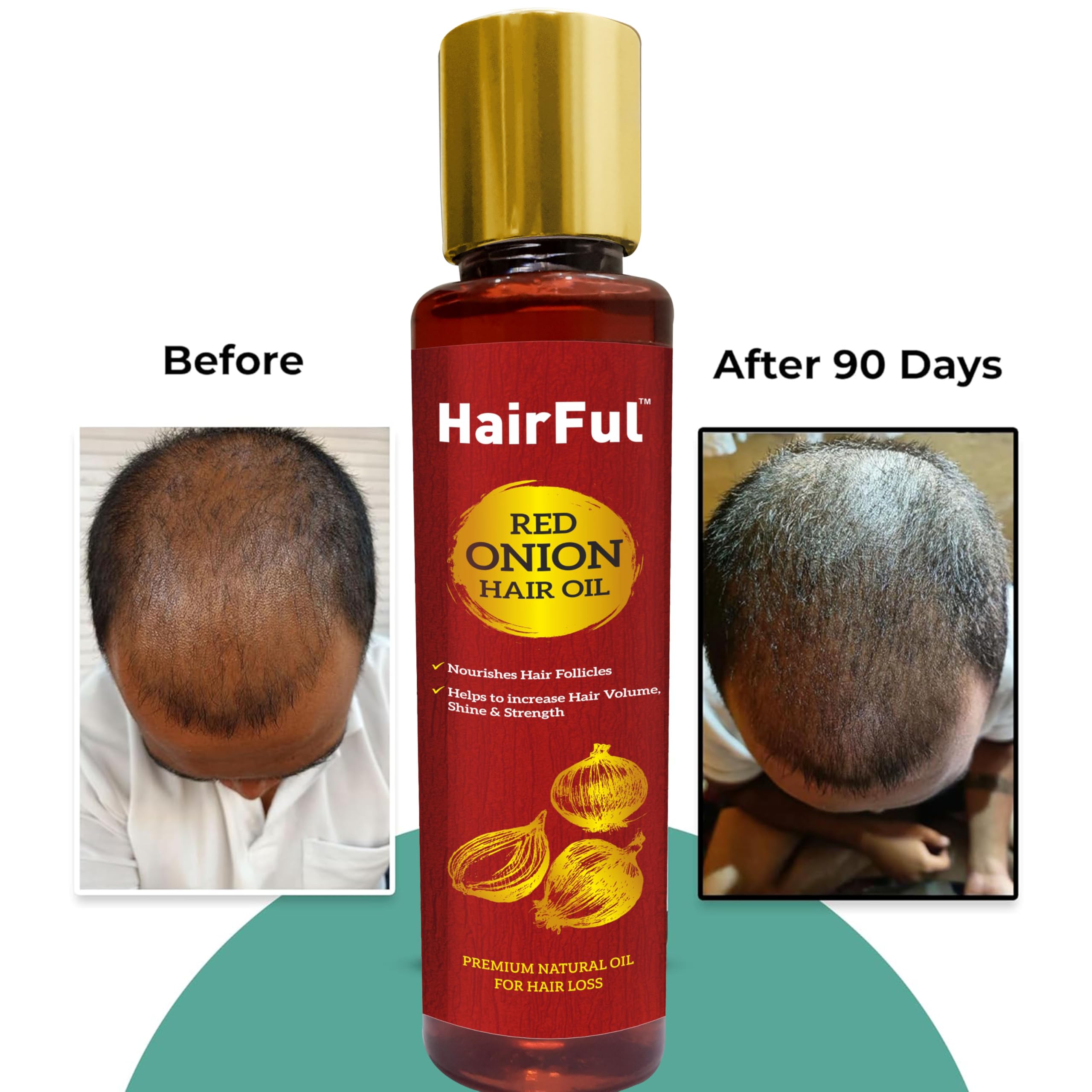 Red Onion Hair Oil for Hair Growth & Scalp Health - Stops Hair Fall, Strengthens Hair, Promotes Thicker & Healthier Hair (120ml) - Perfect for Daily Hair Care & Scalp Nourishment
