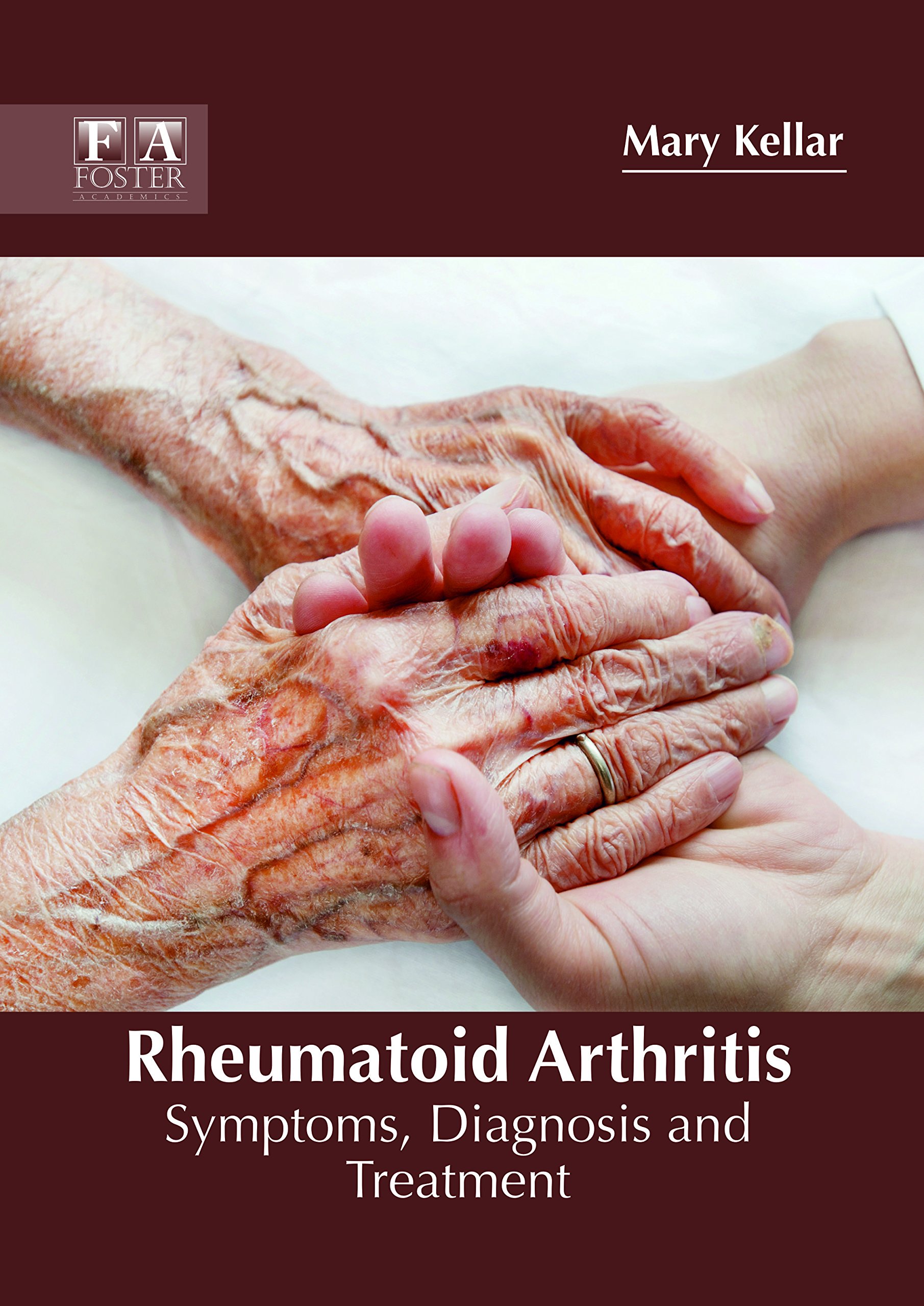 Rheumatoid Arthritis: Symptoms, Diagnosis & Treatment Options | Relief for Joint Pain & Inflammation | Home & Clinical Care Solutions
