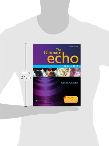 The Ultimate Echo Guide: Smart Speaker Setup, Features & Tips for Home Automation & Music Streaming