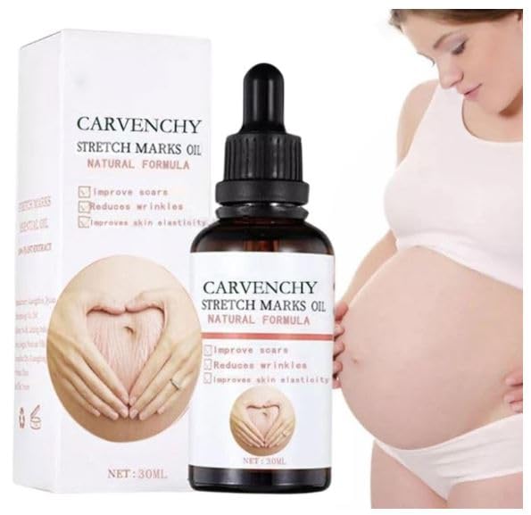 Ramley Stretch Marks Oil for Women - 30ML | Pregnancy Safe, Deep Moisturizing & Skin Repair for Radiant Look | Perfect for Pre & Postpartum Care, Daily Hydration & Stretch Mark Prevention