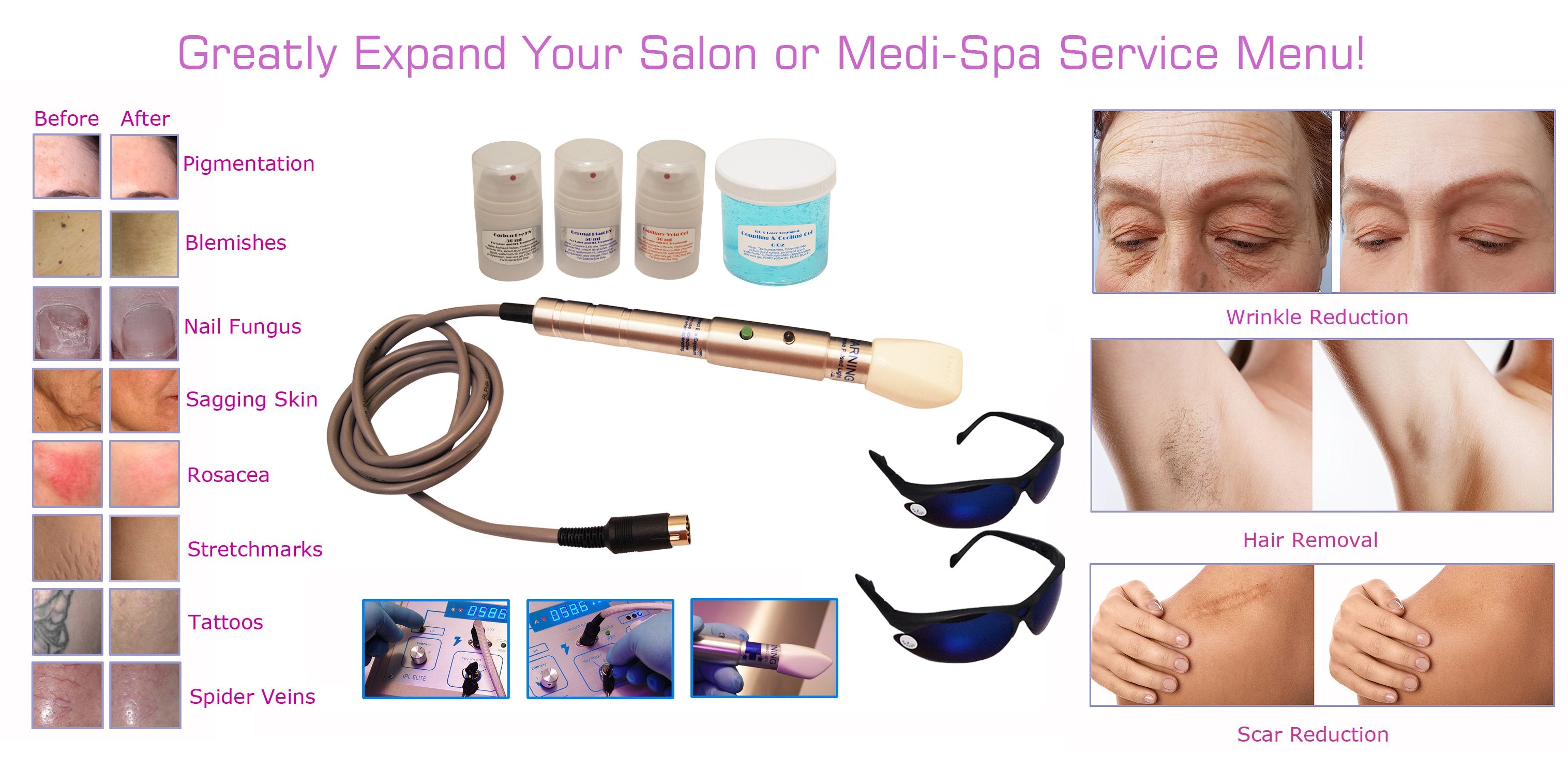 Professional Tattoo Scar & Stretch Mark Removal Machine - Permanent Hair Vein Pigment Reduction, Skin Tightening & Nail Fungus Treatment Equipment for Home & Salon Use