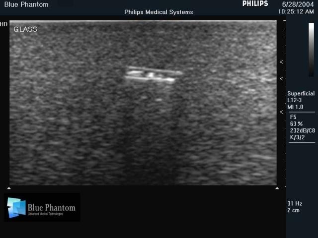 Foreign Body Identification Ultrasound Training Model - High-Quality Medical Simulation Tool for Emergency & Trauma Practice - Perfect for Medical Students, Nurses & First Responders