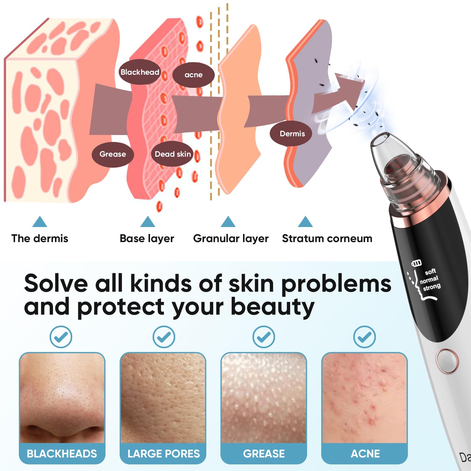 Blackhead Remover Vacuum - Pore Cleaner Tool for Face & Nose | Acne Treatment & Skin Care | Perfect for Daily Facial Cleansing & Spa Days
