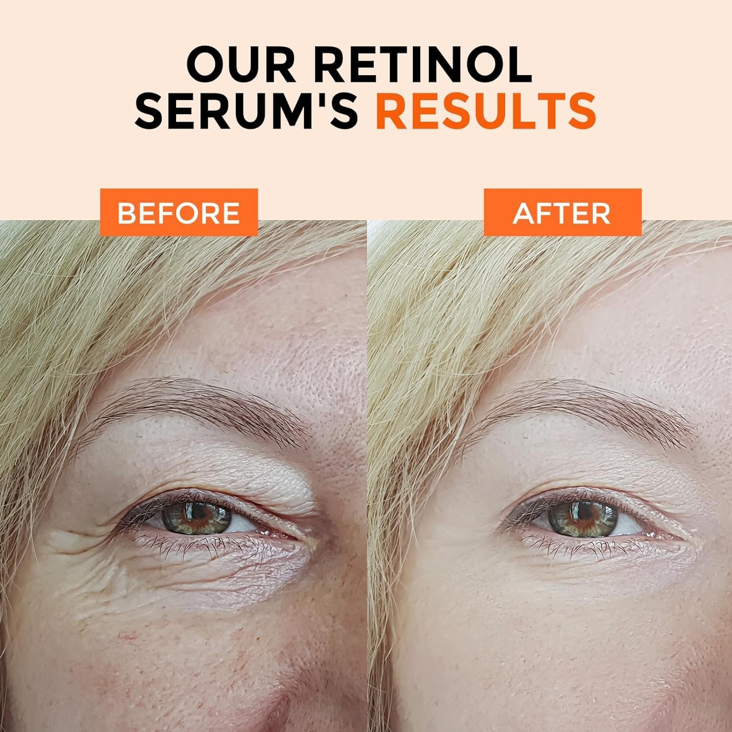 2.5% Retinol Serum for Face with Vitamin C, E & Hyaluronic Acid - Anti-Aging Treatment for Wrinkles, Dark Spots & Dullness - B5 Herbal Resurfacing Formula (2 Pack) | Perfect for Nighttime Skincare Routine & Daily Anti-Wrinkle Care