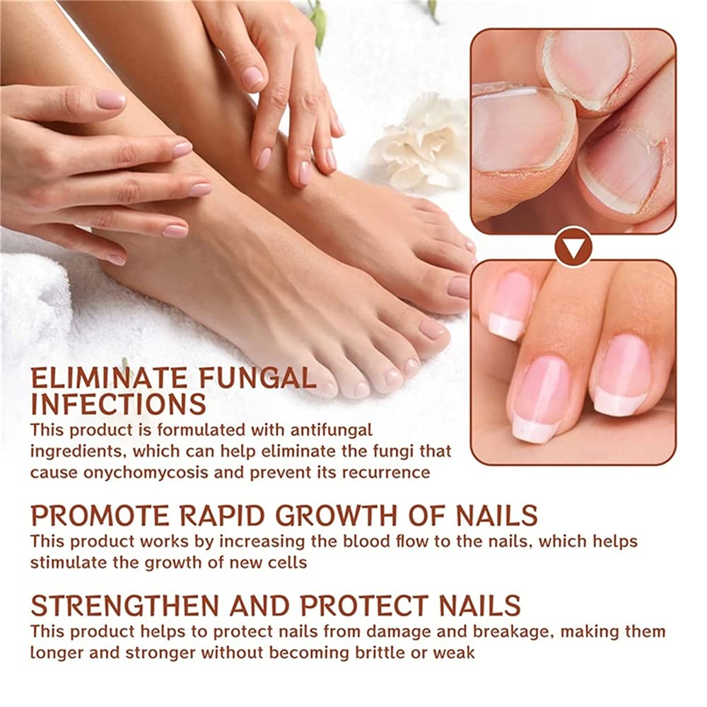 Pisheng 7-Day Nail Growth & Strengthening Serum - 20ml (2-Pack) | Fast Nail Treatment for Stronger, Healthier Nails | Perfect for Brittle Nails & Nail Care Routine