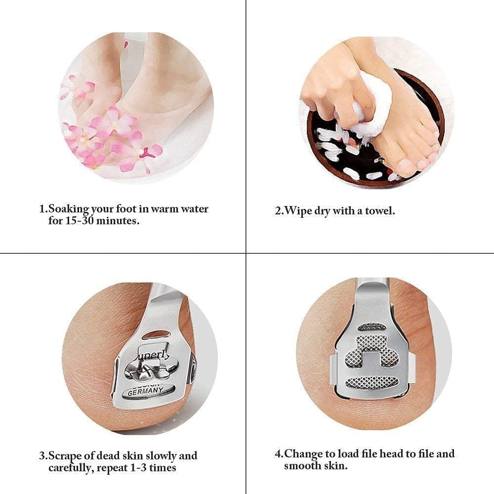 **AISHU Professional Corn Cutter & Callus Remover for Feet – Hard Skin Shaver with 5 Replacement Blades – Effective Foot Care for Cracked Heels & Dead Skin Removal (Home & Salon Use)**