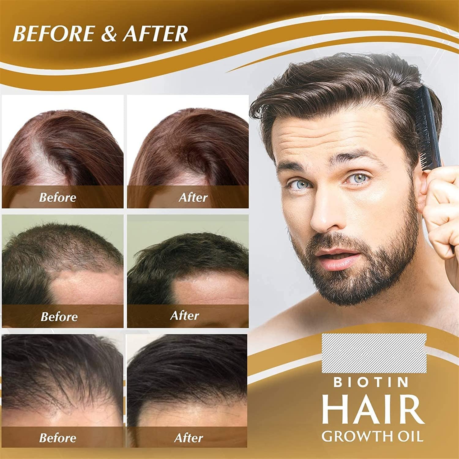 Re'Awaken Biotin Hair Growth Serum & Beard Spray - Hair Loss Treatment for Women & Men | Reduces Hair Loss, Promotes Regrowth & Restores Thinning Hair (3 Pack) | Perfect for Daily Hair Care Routine & Styling