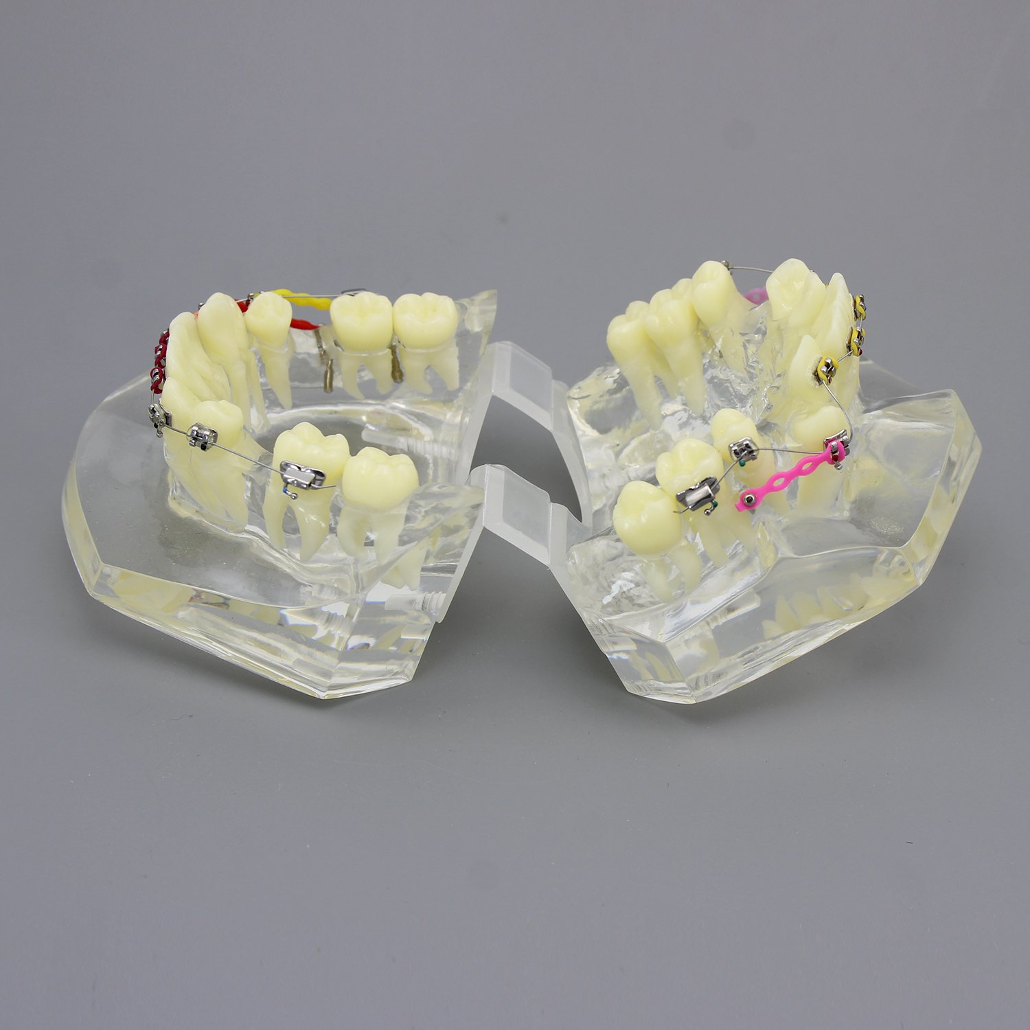 Orthodontic Teeth Model with Metal Brackets & Wires - Dental Malocclusion Treatment Kit with Colorful Ties, Chains & Hoops (M3005) - Perfect for Dental Students, Orthodontic Training & Patient Education