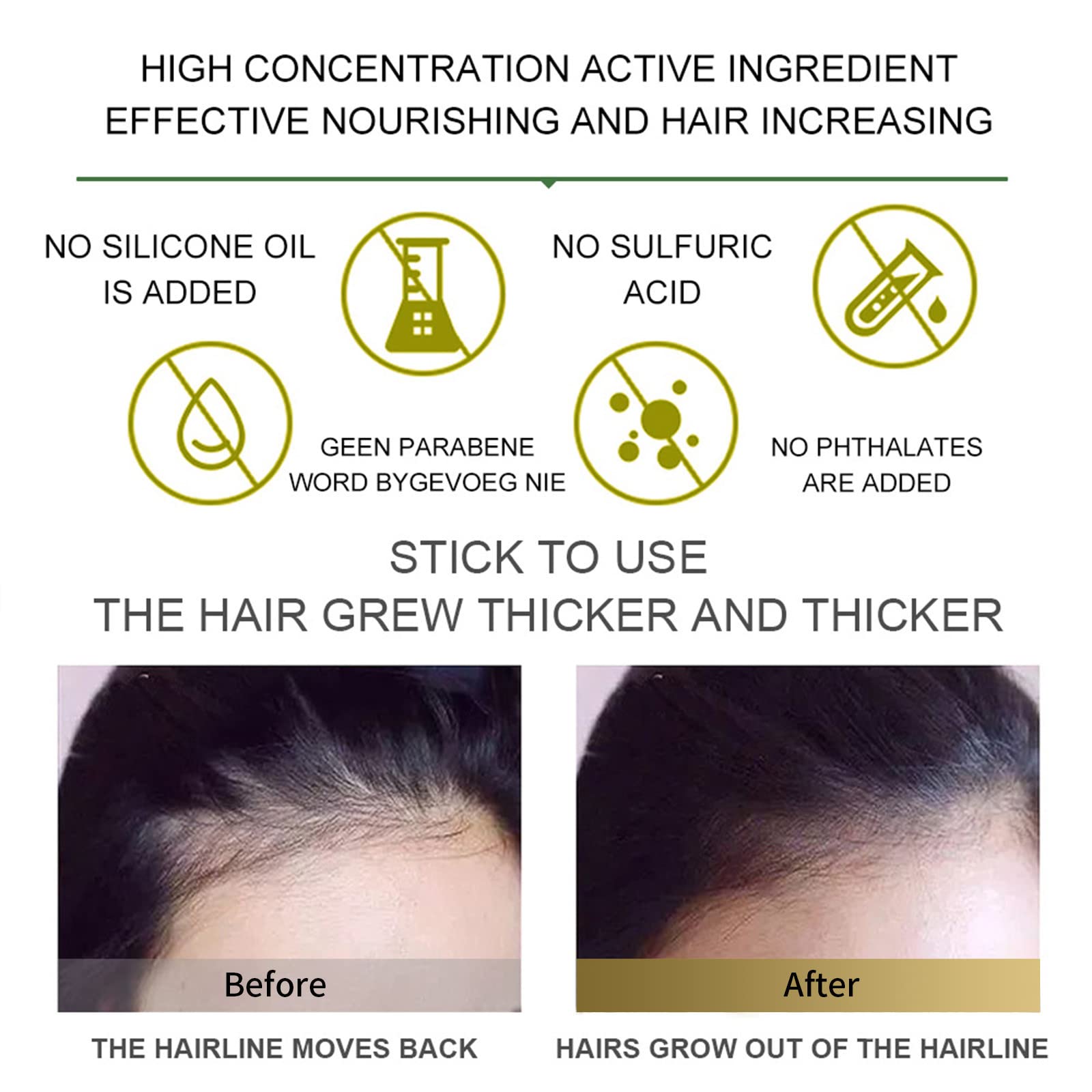 **Ginger Hair Growth Oil for Women & Men - Natural Hair Treatment Serum to Stop Hair Loss, Promote Thicker & Healthier Hair - Ideal for Daily Scalp Care & Thinning Hair Treatment (Yellow)**    **Usage Scenarios:** Perfect for daily hair care routines, promoting thicker hair growth, reducing hair loss, and improving scalp health for both men and women.