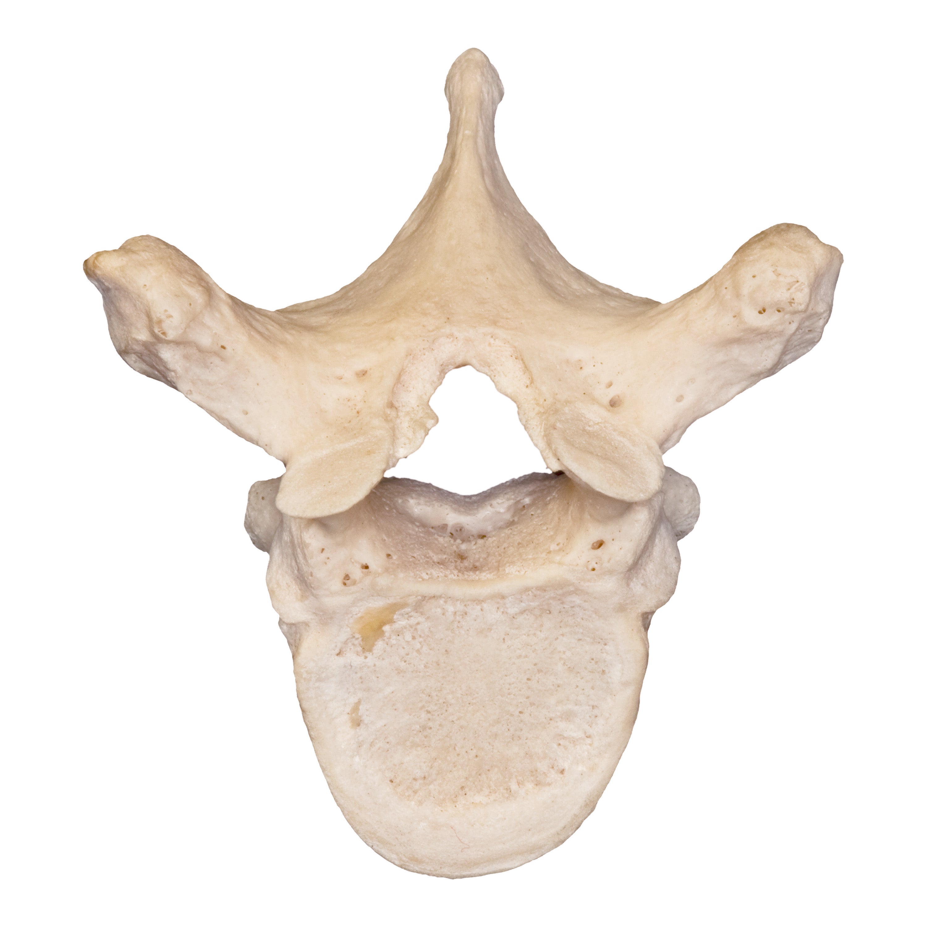 Premium Human Vertebrae Specimen for Medical Research & Education - Ideal for Anatomy Study, Medical Training, and Forensic Science Applications