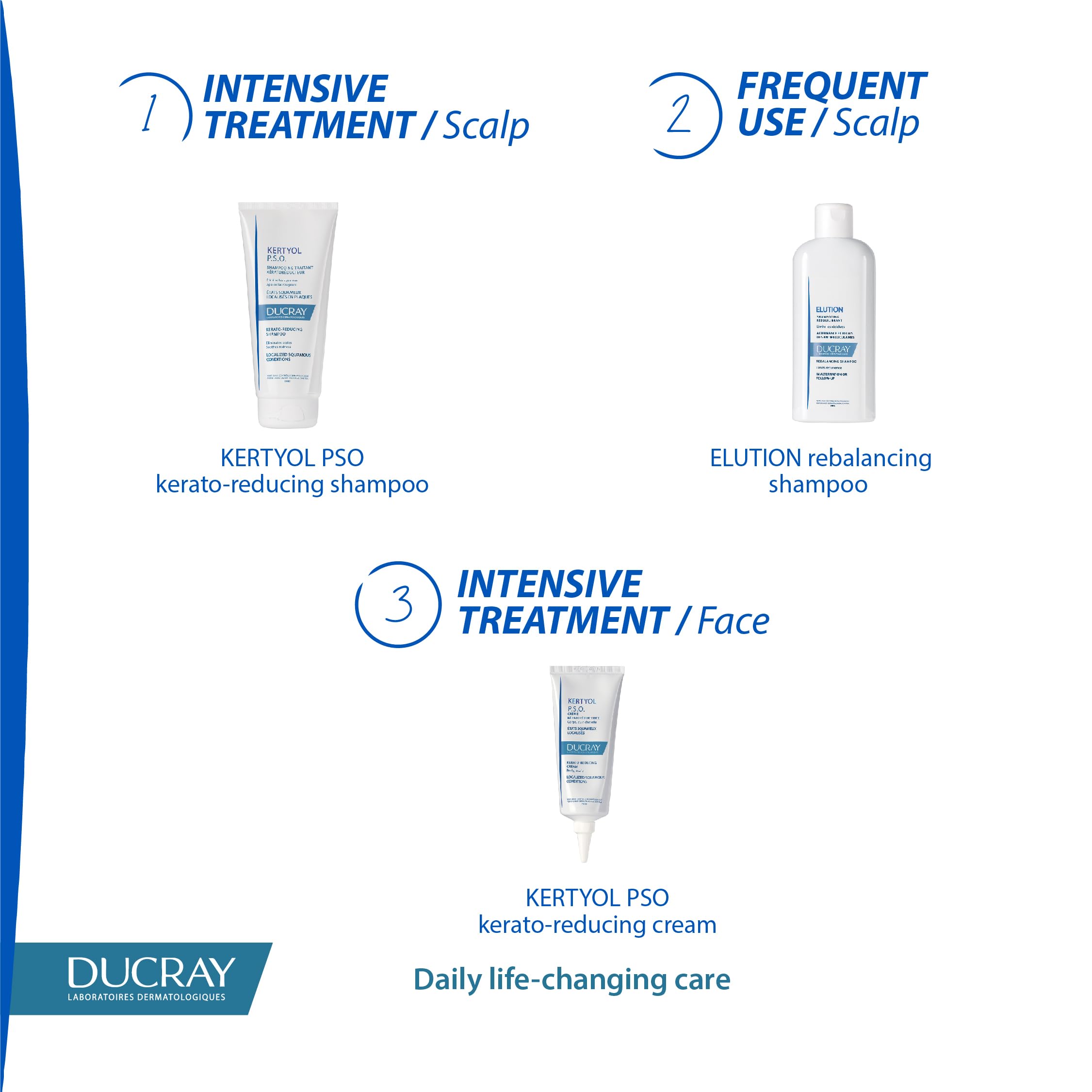 Ducray Kertyol P.S.O. Treatment Shampoo for Scalp Psoriasis & Dandruff - 200ml | Soothes Itching & Flaking | Dermatologist Recommended for Sensitive Scalp