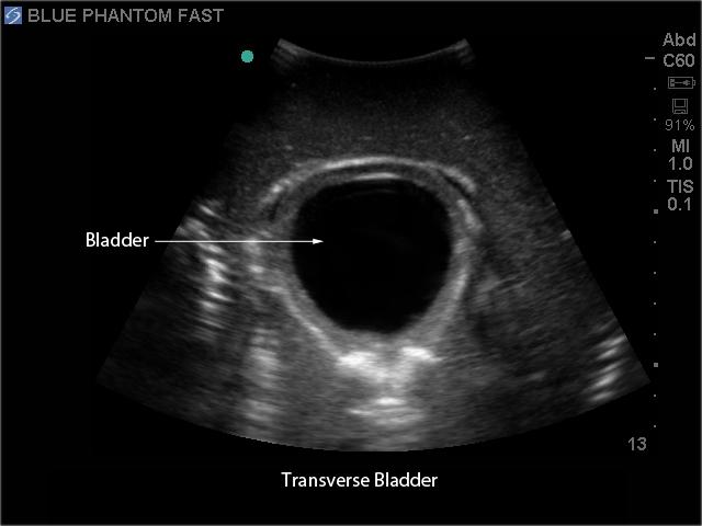 FAST Exam Real Time Ultrasound Training Model - Transthoracic Only for Emergency Medicine & Trauma Assessment Practice (Medical Simulation, Sonography Education, TTE Training)