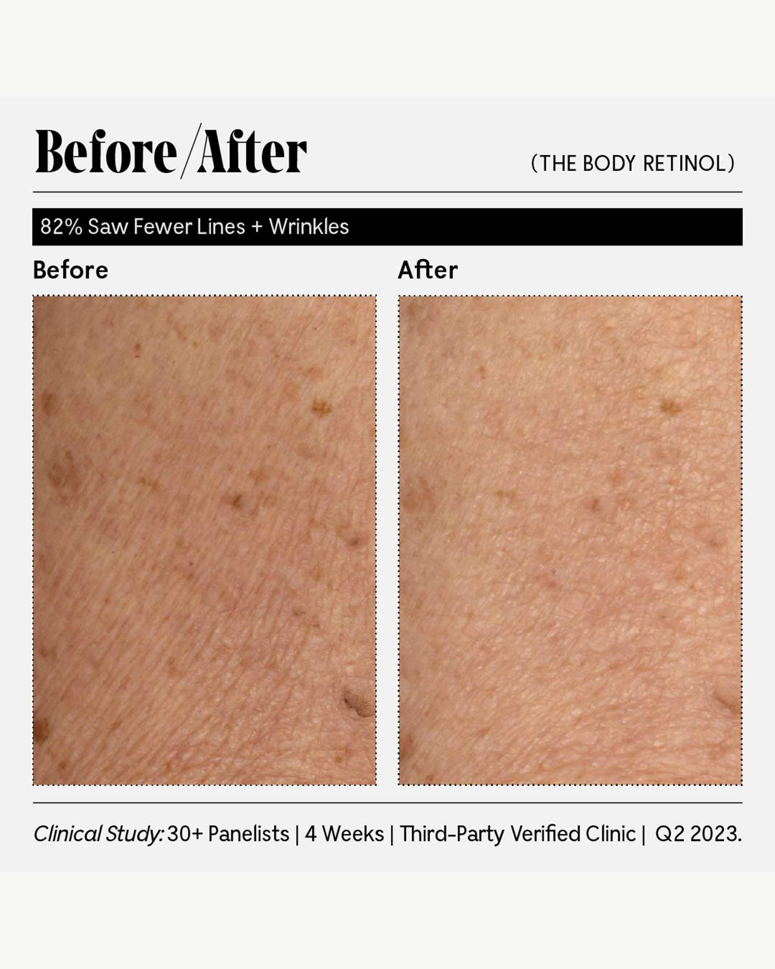 Premium Retinol Cream for Face - Anti-Aging & Wrinkle Reduction Treatment - Night Moisturizer for Smooth, Youthful Skin | Perfect for Daily Skincare Routine & Nighttime Regimen