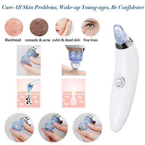 DIYASHI® Blackhead Vacuum Pore Cleaner - Acne & Pimple Remover for Nose & Face - Deep Cleansing Device for Blackheads & Clogged Pores | Perfect for At-Home Skincare & Spa Treatments