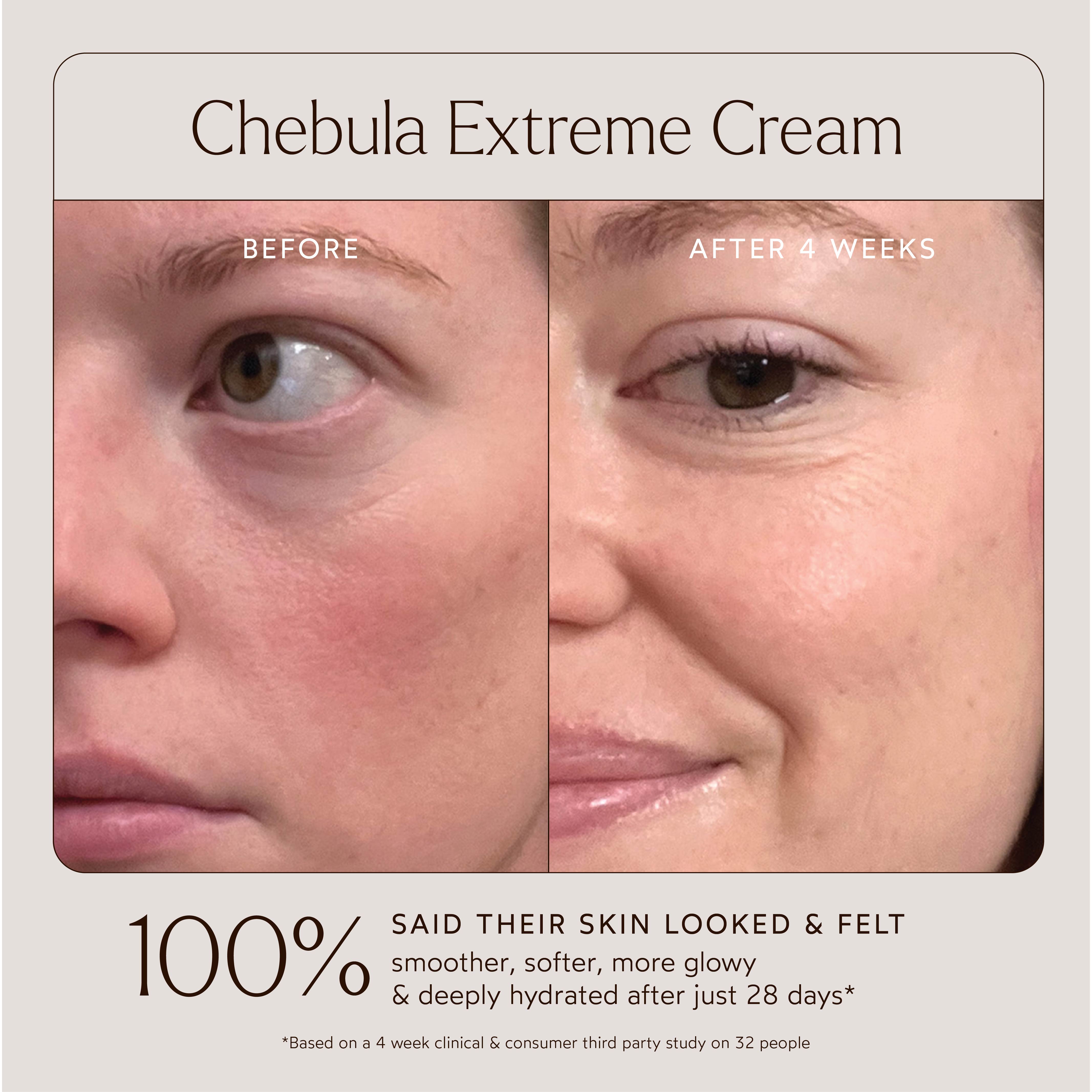 Renew Chebula Extreme Cream – Anti-Aging Face Moisturizer for Wrinkles & Fine Lines | Hydrating & Firming Skincare for Daily Use