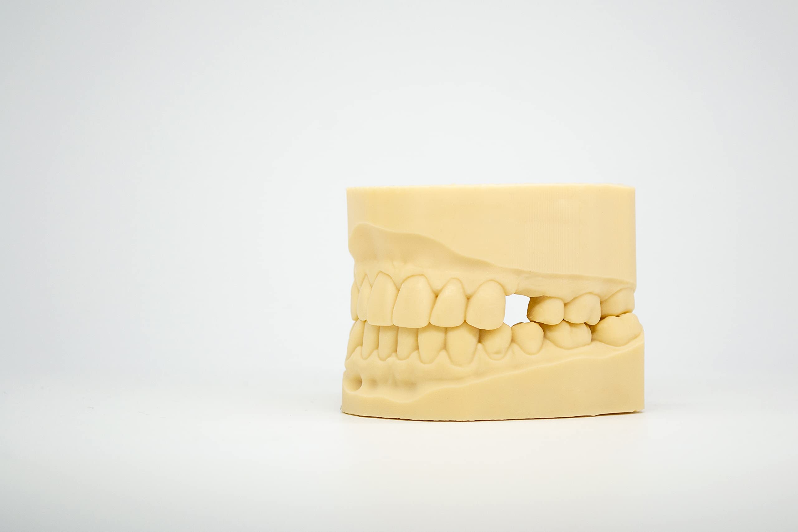 High Accuracy Dental 3D Printer Resin for LCD MSLA UV Printers - DMD-21 Fast Curing Model Resin (1kg, Sand Beige) - Perfect for Dental Crowns, Bridges & Orthodontic Models