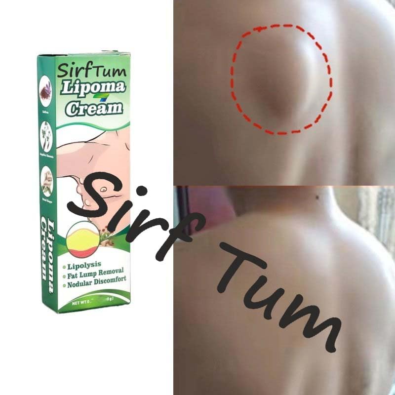 Lipoma Removal Cream - Fast Acting Lipoma Treatment Ointment for Lipoma Elimination & Cellulite Reduction - Anti-Swelling Lymphatic Massage Cream (3 Pack) - Perfect for Home Use & Professional Skin Care