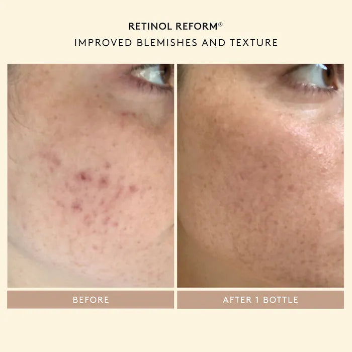 Shani Darden Retinol Skincare Set - Cleansing & Hydration Starter Kit for Anti-Aging & Glowing Skin | Perfect for Nighttime Routine & Sensitive Skin Care