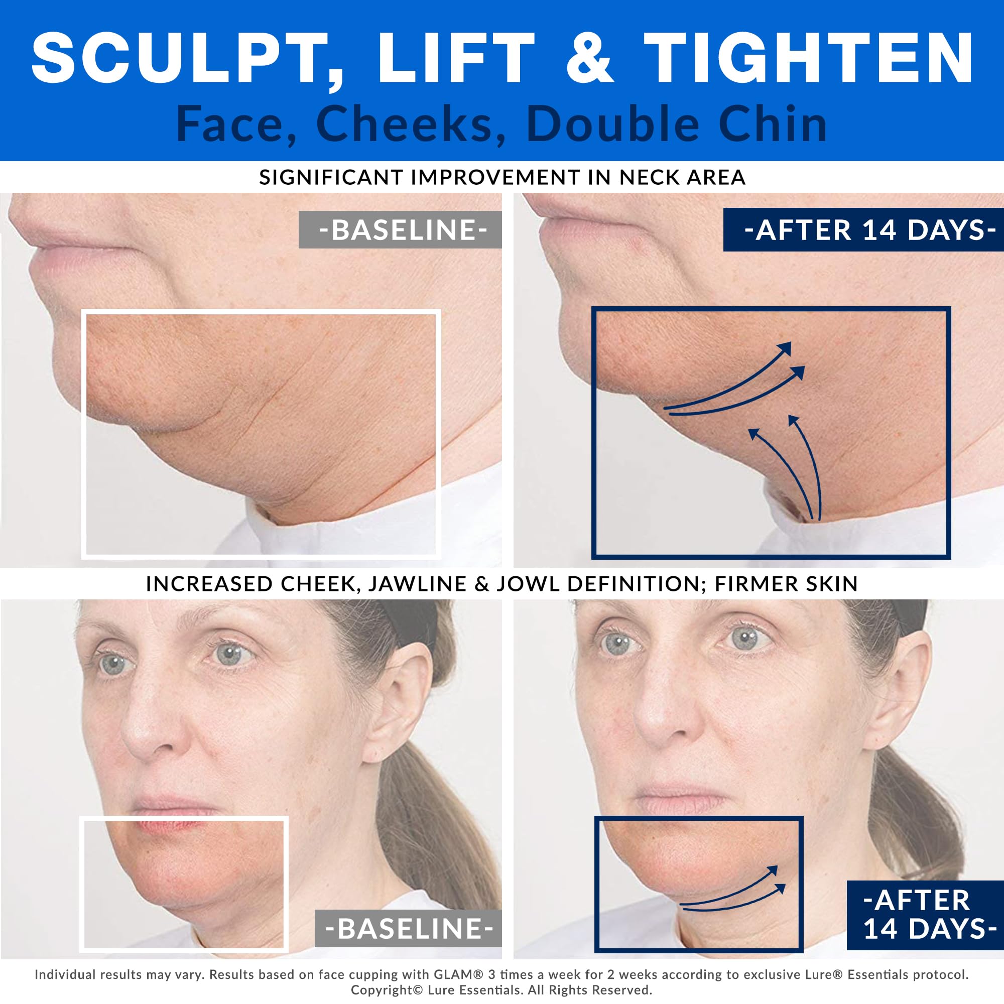 Professional Glass Facial Suction Cup - Medium Size 2 for Anti-Aging Facelift, Wrinkle Reduction & Lymphatic Drainage Massage | At-Home Spa Treatment & Professional Skincare Tool