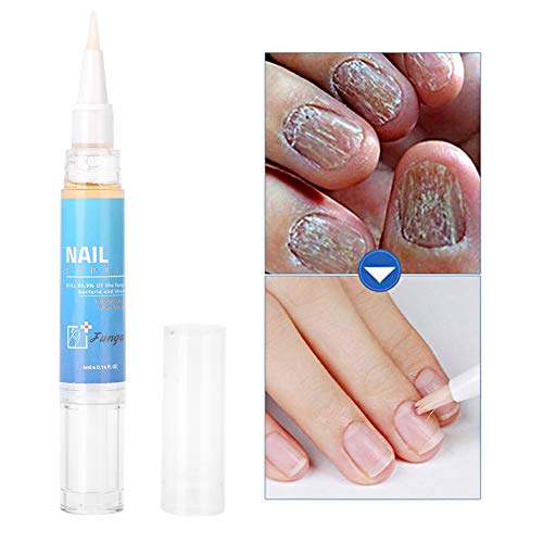 Natural Nail Care Cream - Deep Sterilization & Fungus Removal Treatment with Herbal Formula | For Toenail & Fingernail Fungus, Athlete's Foot & Healthy Nail Maintenance