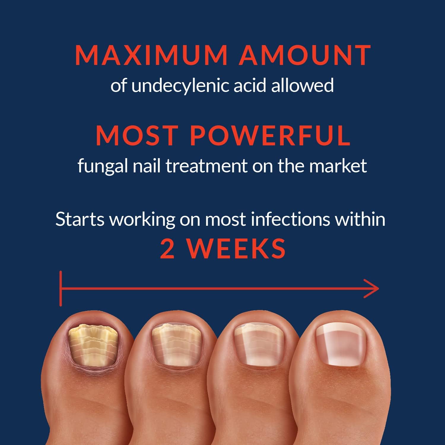 Nail Max Extra Strength Toenail & Finger Fungus Treatment - Fast-Acting Anti-Fungal Liquid Solution for Healthy Nail Growth - Safe for Adults & Kids (0.5 fl oz) - Perfect for Athletes, Swimmers & Pedicure Lovers